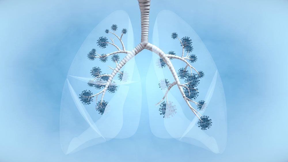 An artist's rendering of lungs with coronavirus inside.
