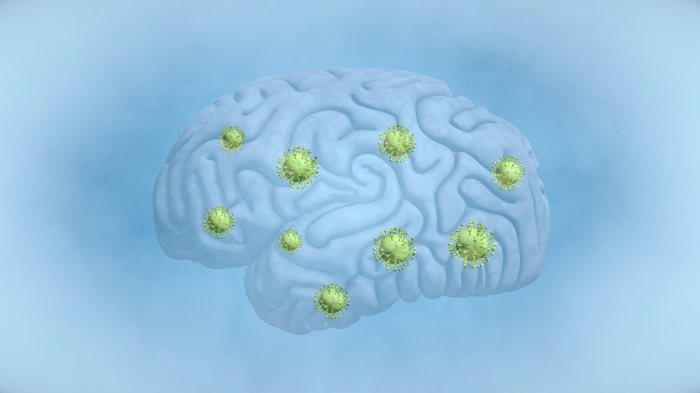 An artist's rendering of a human brain with coronavirus inside it.